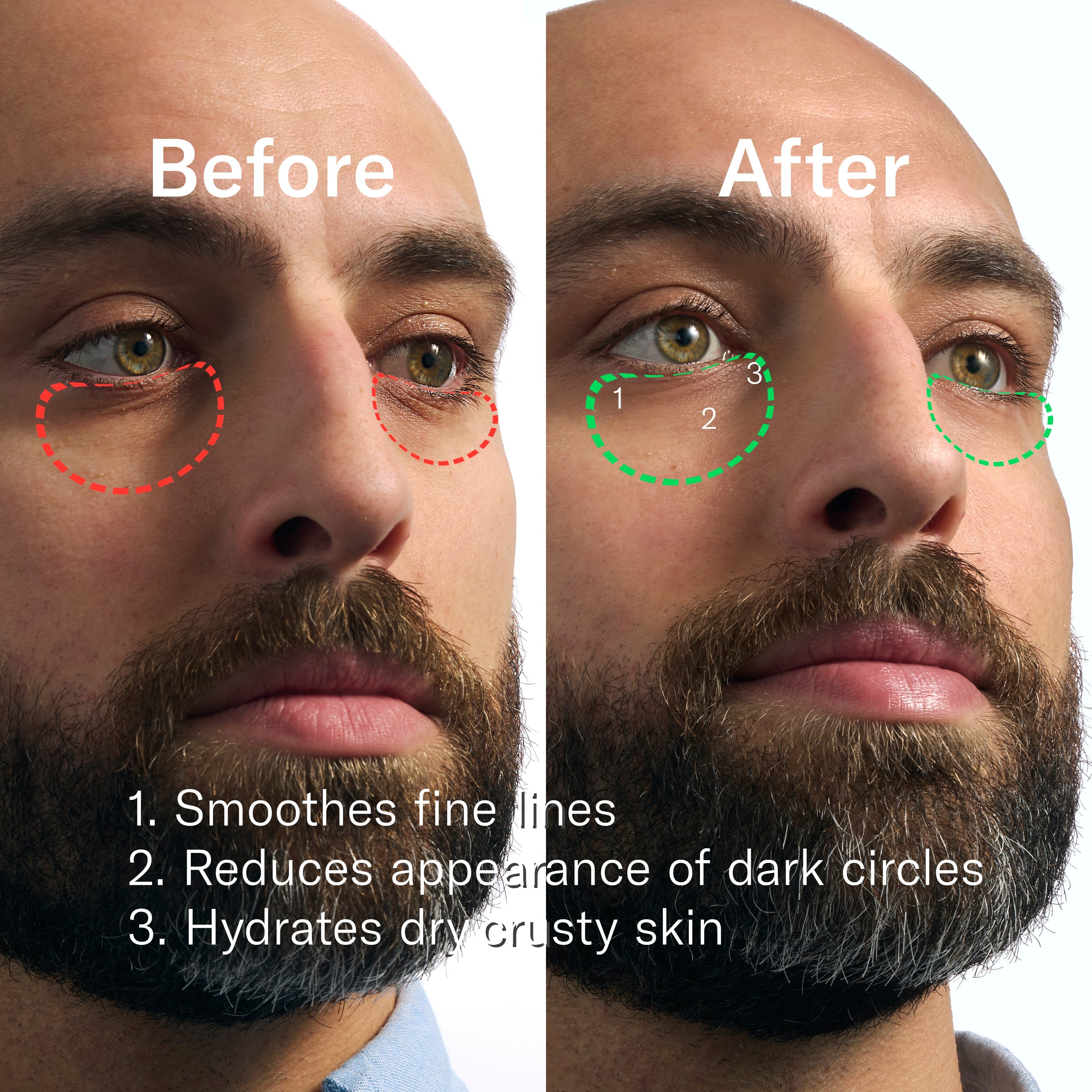 Rapid Restore Eye Patches - 6 pack - Travel Ready Close Shave Tools